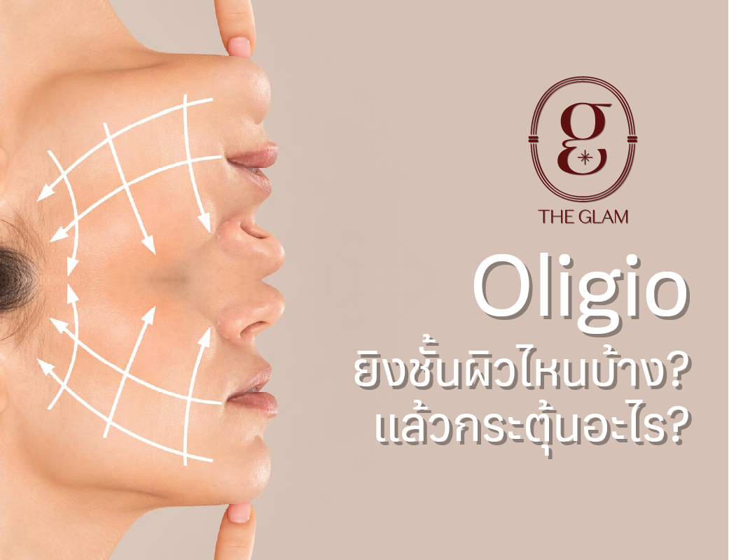 Oligio ยิงชั้นผิวไหนบ้าง? แล้วกระตุ้นอะไร?
